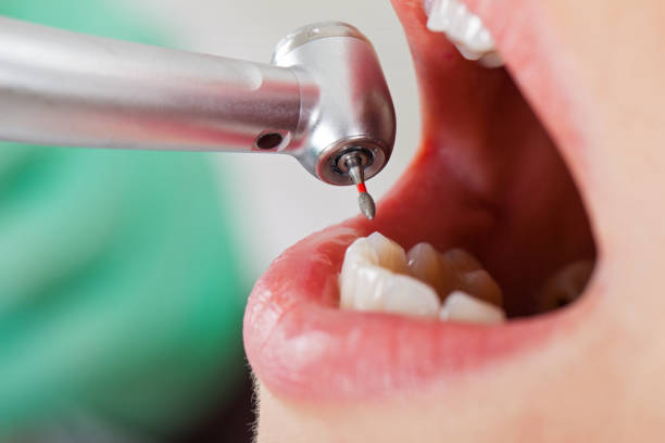 Best Urgent Dental Care  in Wofford Heights, CA